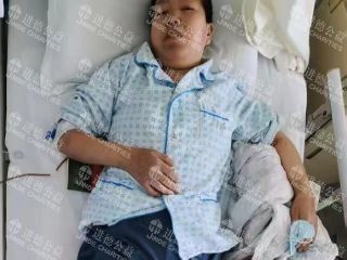 2541   蒋*红急性髓系白血病求助