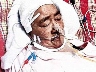 2597 王*芳突发脑出血重症，困难家庭亟待援手