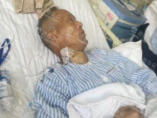 26013   刘*臣右肾恶性肿瘤切除后又发现双肺结节、肿块增大