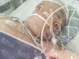 26017  郭*海突发脑出血求助