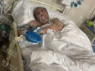 26025  马*义脑出血求助