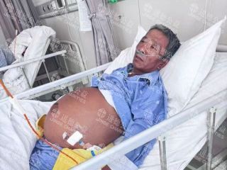 26027   44岁浪*舜乙肝、肝硬化腹水求助