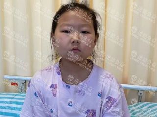 26064   9岁女孩王*好重型再生障碍性贫血求助
