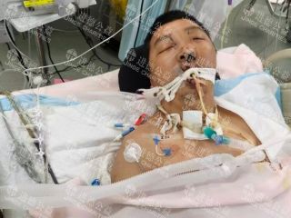 26076   44岁马*德被暴晒油桶突发爆炸冲击到头部请求帮助