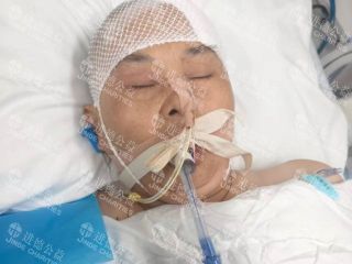 26079 刘*红骑电车不慎跌倒致脑出血